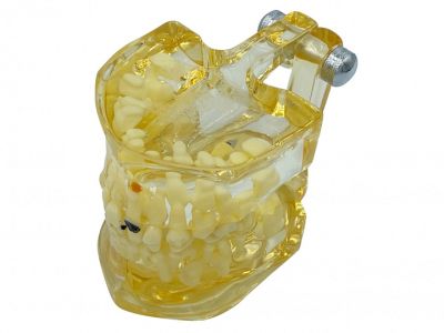 Модель прозрачная детская патология