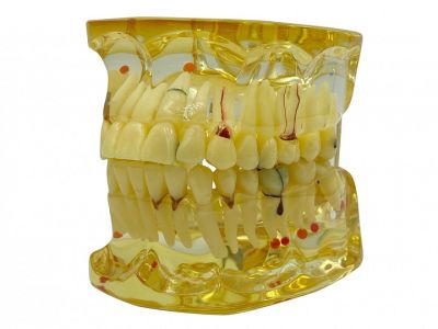 Модель прозрачная взрослая 32 зуба