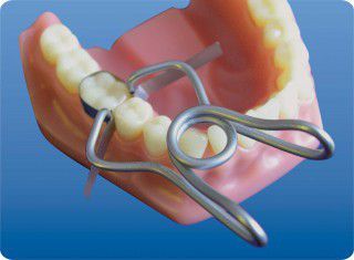 ТОР 1,009 Фиксатор пружинный