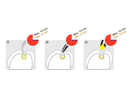 Prebond-бонд V поколения, флакон 5мл, President Dental Germani