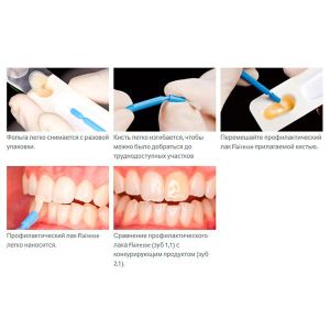 Flairesse профилактический лак прозрачный, 1 блистер, 220404, DMG