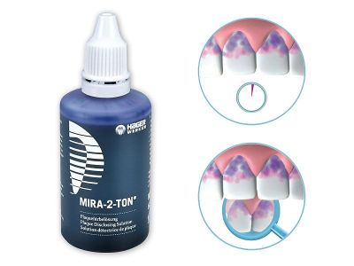 Mira-2-Ton - раствор-индикатор налета, 60 мл, miradent