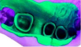 Durosil S Light Body 140мл.