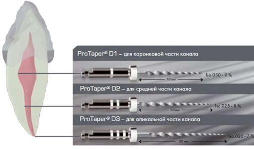 ProTaper Retreatment D2 (6 шт.)- для распломбировки каналов